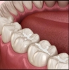 root canal dentist Frisco Avatar